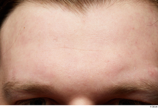 HD Face Skin Robert Watson eyebrow face forehead skin pores…